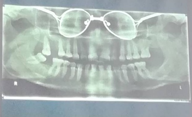 Семинар Дмитрия Рогацкина «Лучевая диагностика в амбулаторной практике врача-стоматолога»